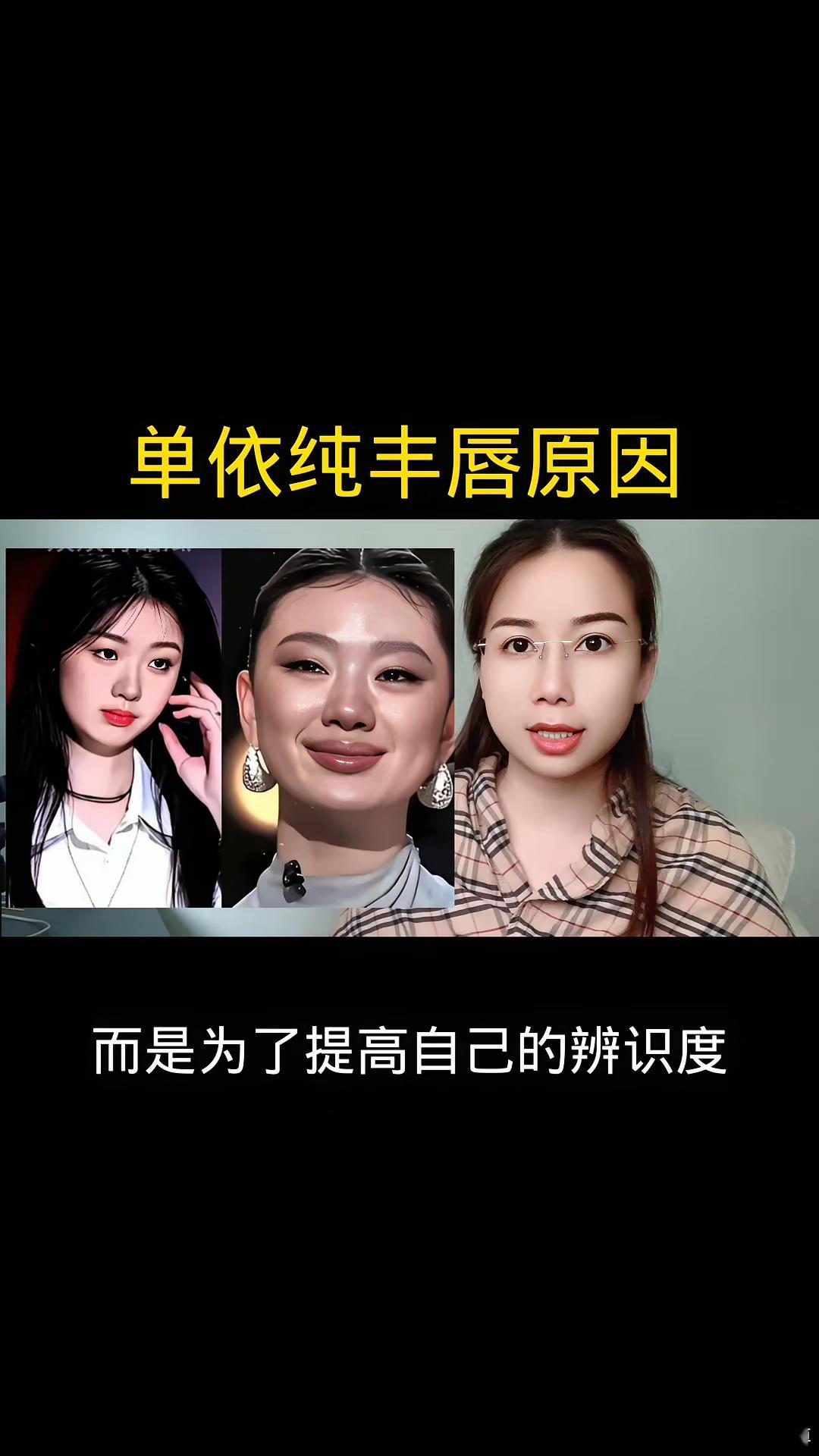 单依纯丰唇原因。原来单依纯丰唇并不是因为好看，而是为了提高自己的辨识度。刚出道的
