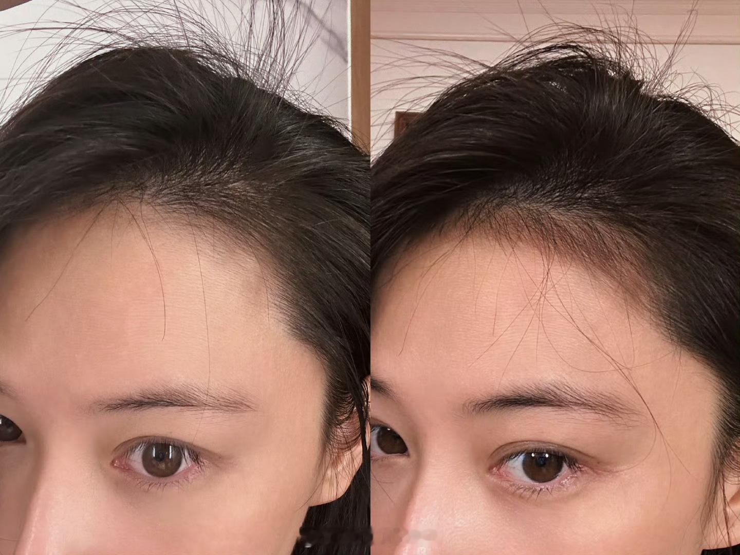 【张馨予】 张馨予消失的头发回来了 姐这我是真需要[泪][泪] 