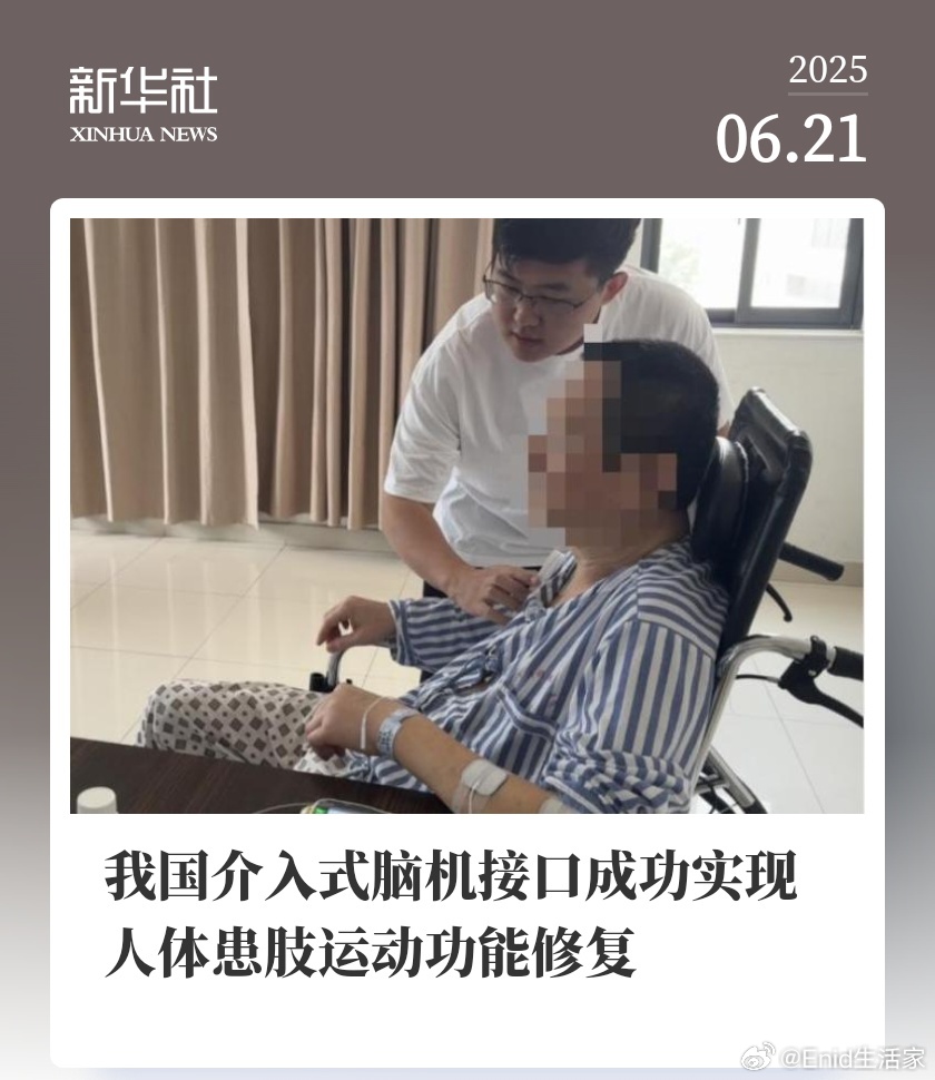 我国介入式脑机接口成功实现人体患肢运动功能修复据新华社报道，全球首例介入式脑机接