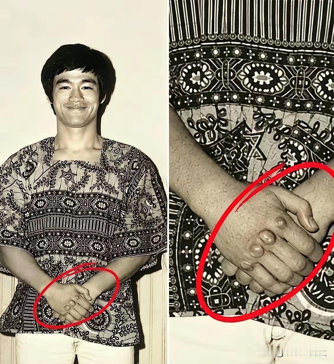 李小龙双手留下累累练拳痕迹，都是日复一日硬核训练打磨而出
 
看过李小龙手部特写