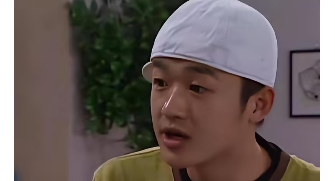 炸锅了！包贝尔自曝医美翻车，打肉毒素影响工作，连生气都演不了 