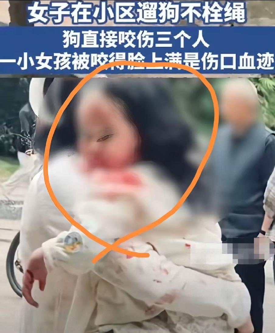 出大事了。9月12号下午，眉山仁寿县普宁街道一个小区里，一条牛头梗疯了似的咬人。