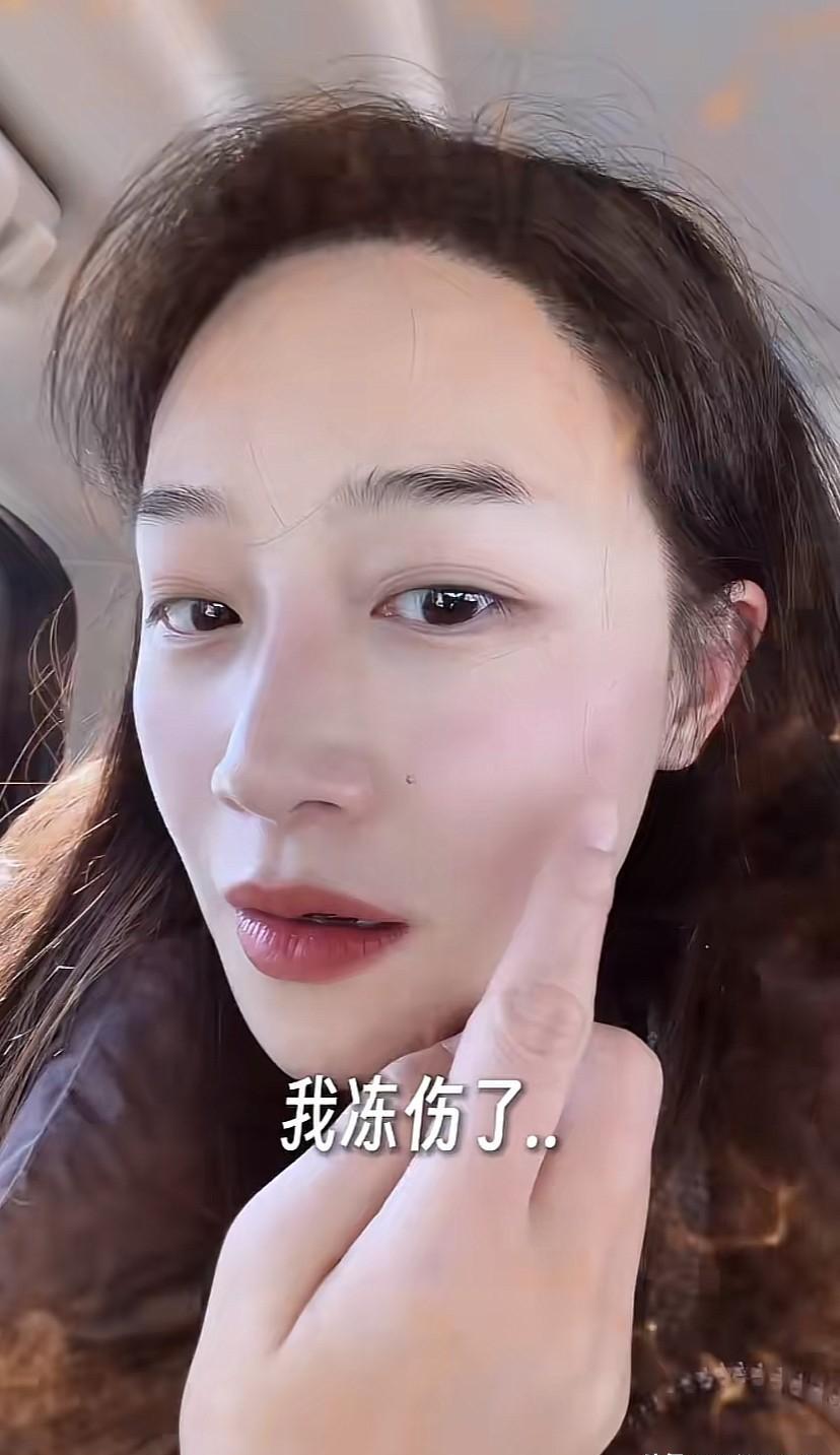 蓝盈莹的脸，被零下24度的雪“咬”了。
仅仅半小时，没戴口罩。
南方人低估了北方