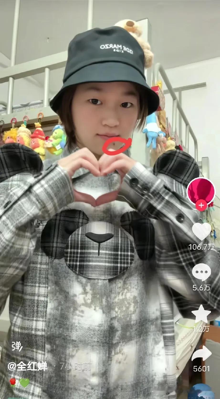 刚开始我真的不明白全红婵

为什么不把嘴角的痣给点掉，

后来才明白她这个痣看起