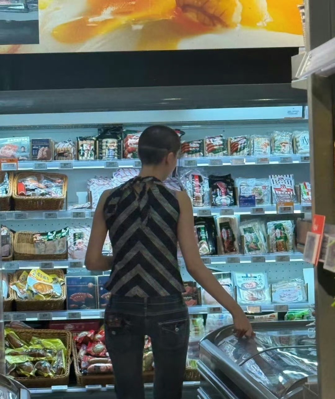 金子涵后脑勺的疤痕是怎么回事 