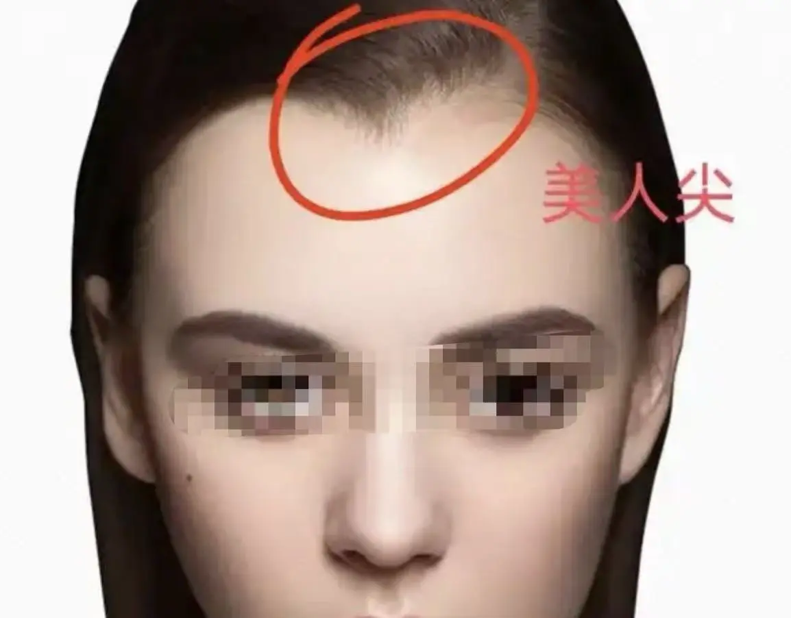 美人尖太尖，太大的人，或者过长都会冲击到印堂，容易与父或母缘份淡薄，三...