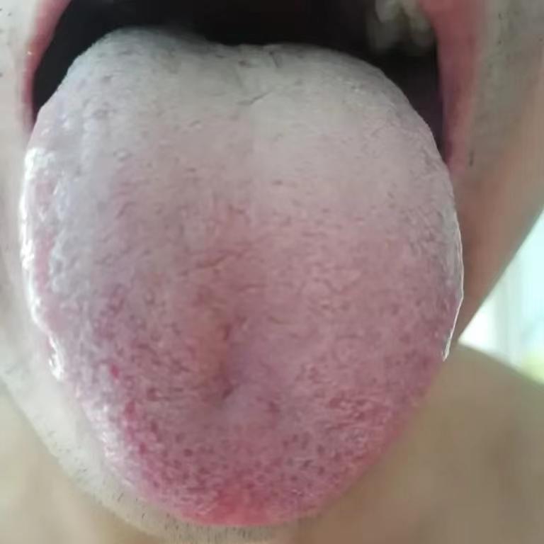 上热下寒，难怪欲望大，却软短难坚，房市不兴！
这位粉丝前两天咨询我，问何大夫，我