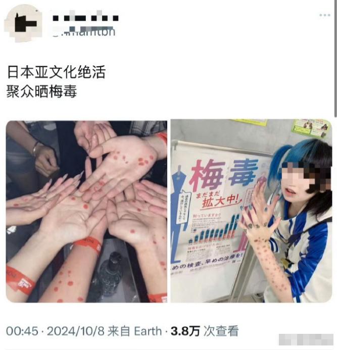 日本东京，竟成了梅毒之城[微风]
日本梅毒成灾，“不是为了传给客人，谁得了花柳病