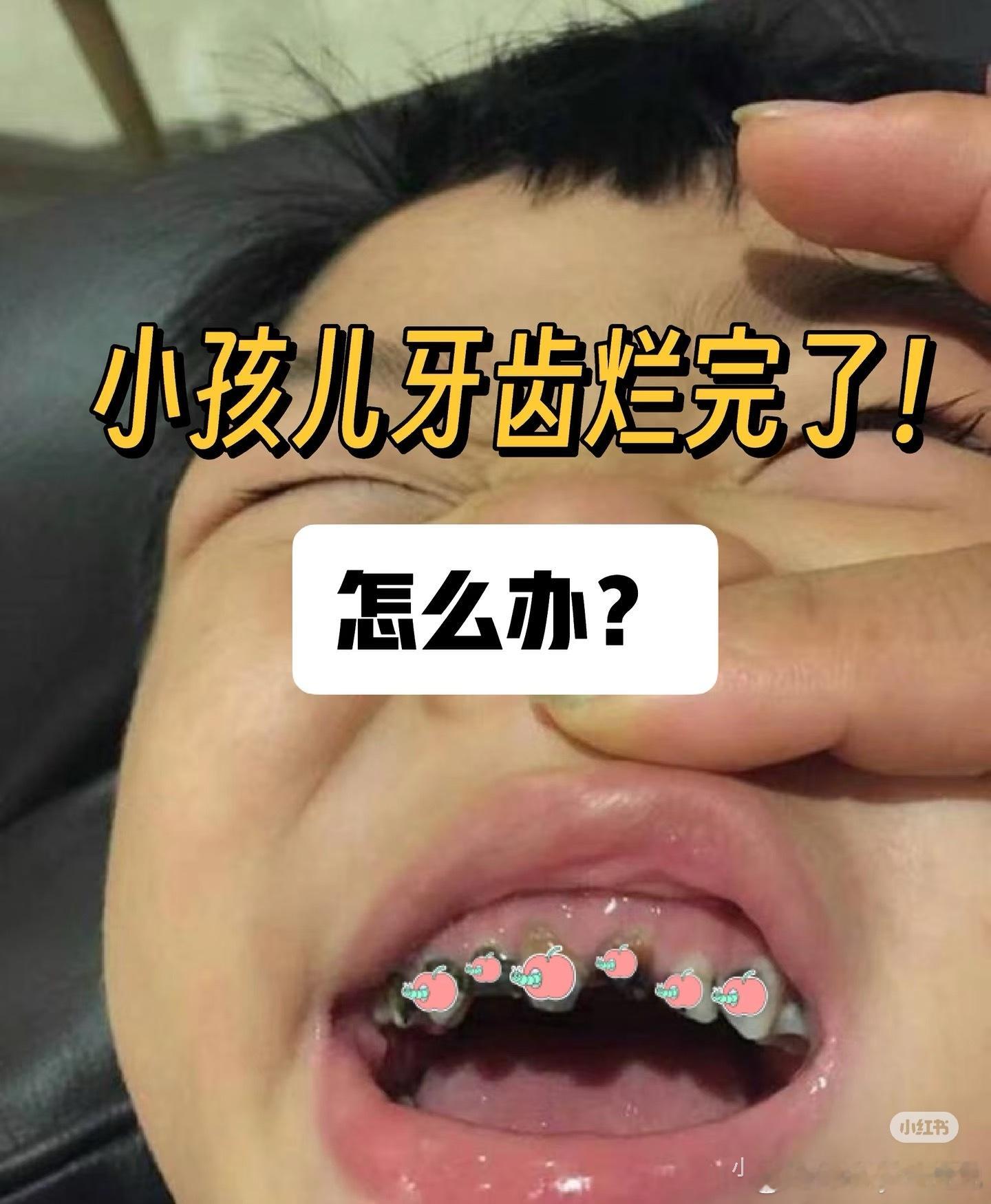 原来这么多年牙齿都在负重前行真的羡慕牙齿好的，那真是一笔财富。我从小牙齿就不太好
