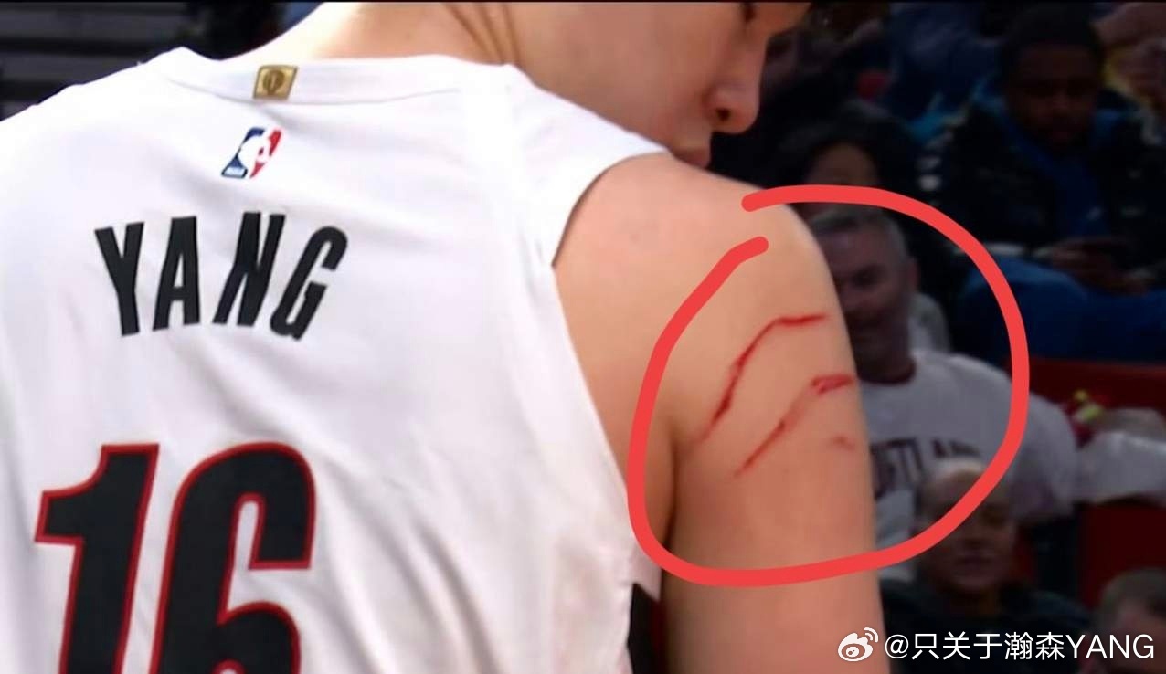 杨瀚森手臂上血痕累累， 这是亚当斯的指甲血吗杨瀚森五犯下场被吹出表情包