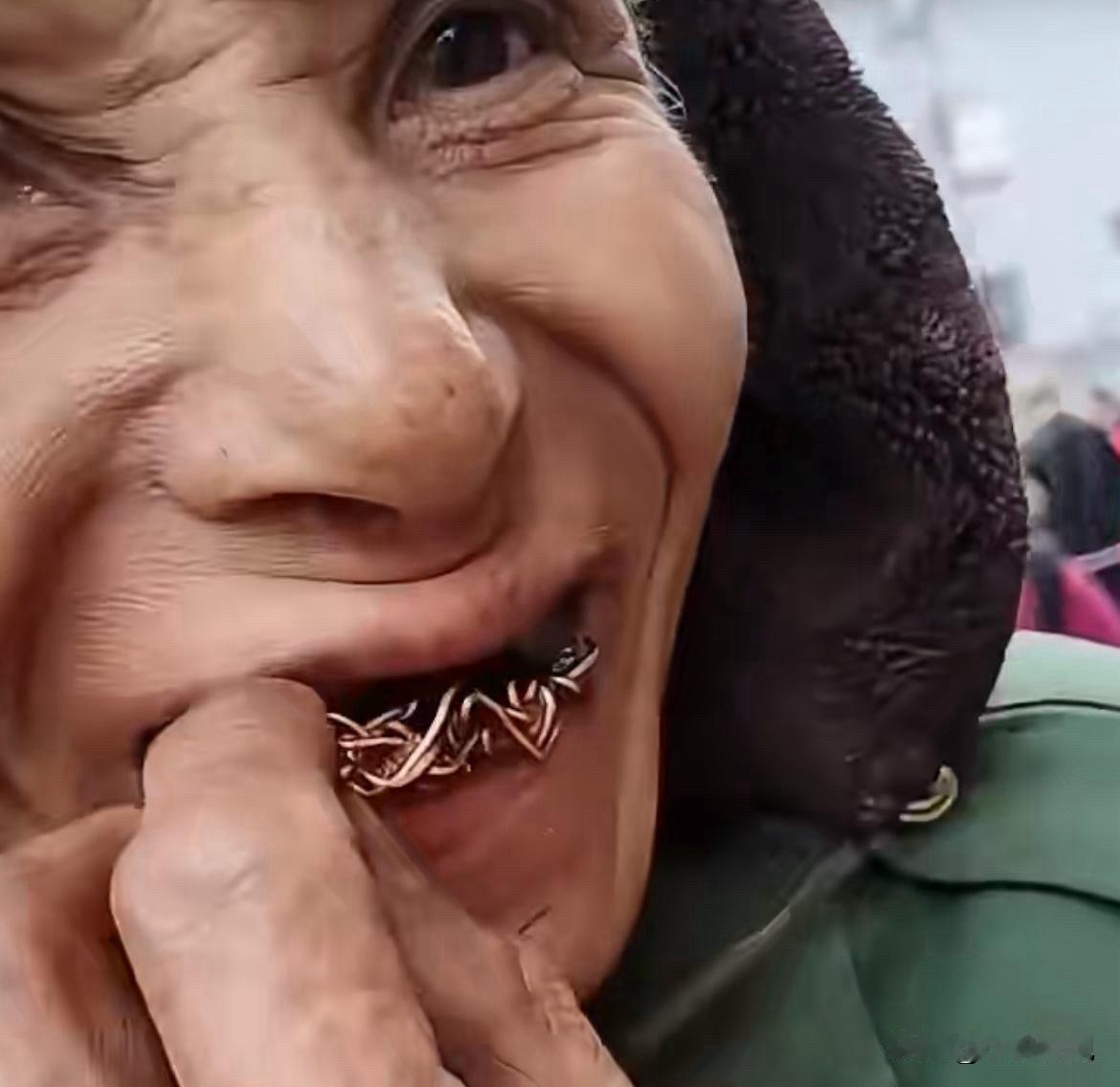 大冷天看到这一幕，我心里真不是滋味：四川一老大爷赶集，嘴里竟然全是铜丝搅的“假牙