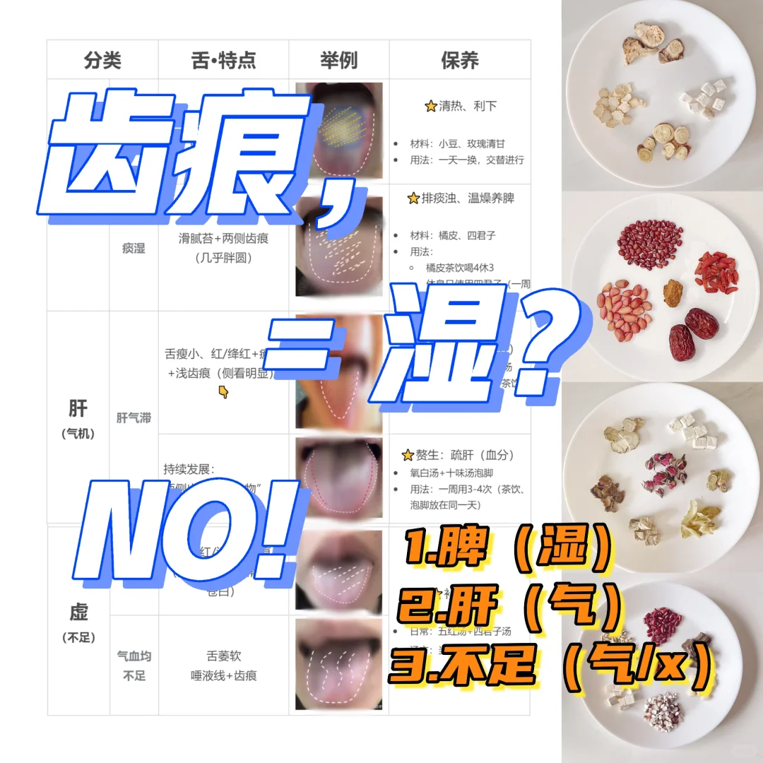 齿👅痕，都是水湿吗❓no！还有气滞、不足