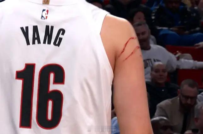 杨瀚森今天也是浴血奋战，他的手臂在第四节被划出两道血痕，目前贡献3分3篮板2助攻