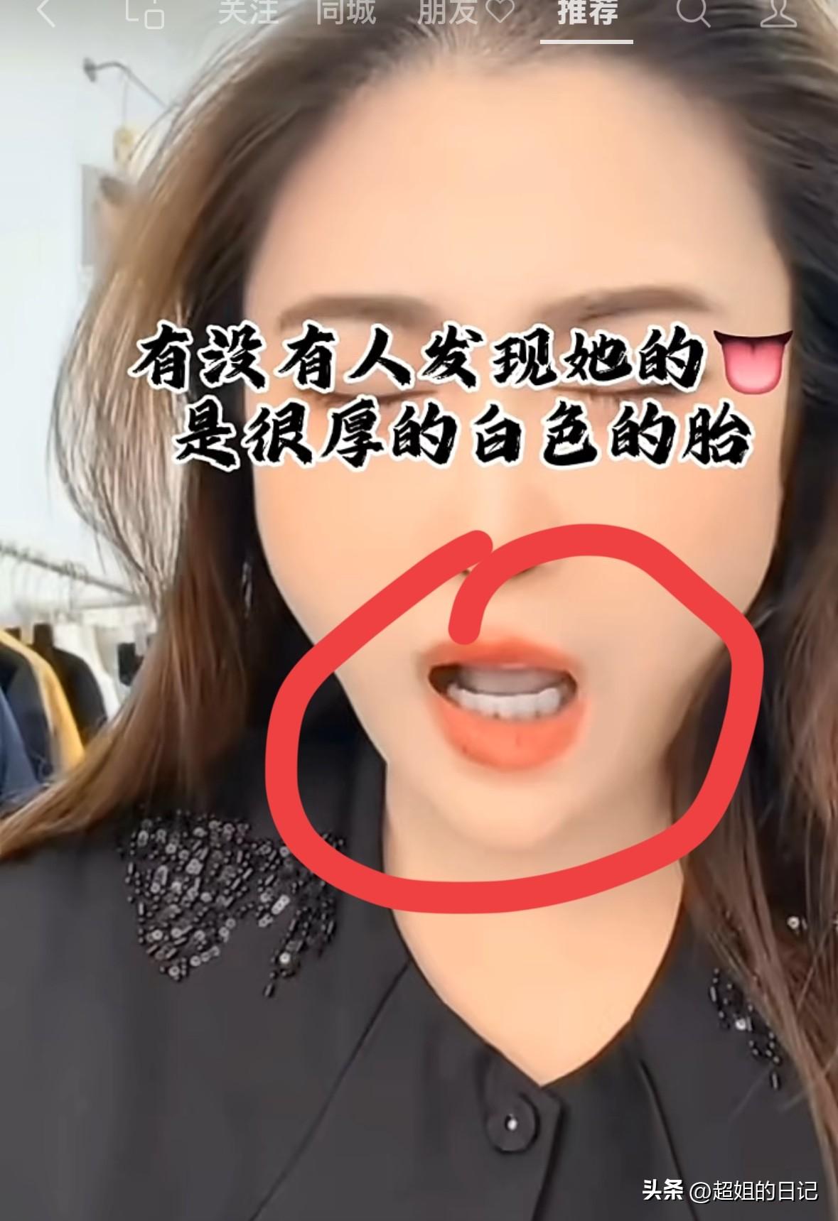 39岁主播直播期间突发疾病，被发现她发病时候的舌头居然是白色的，看着就不对劲儿，