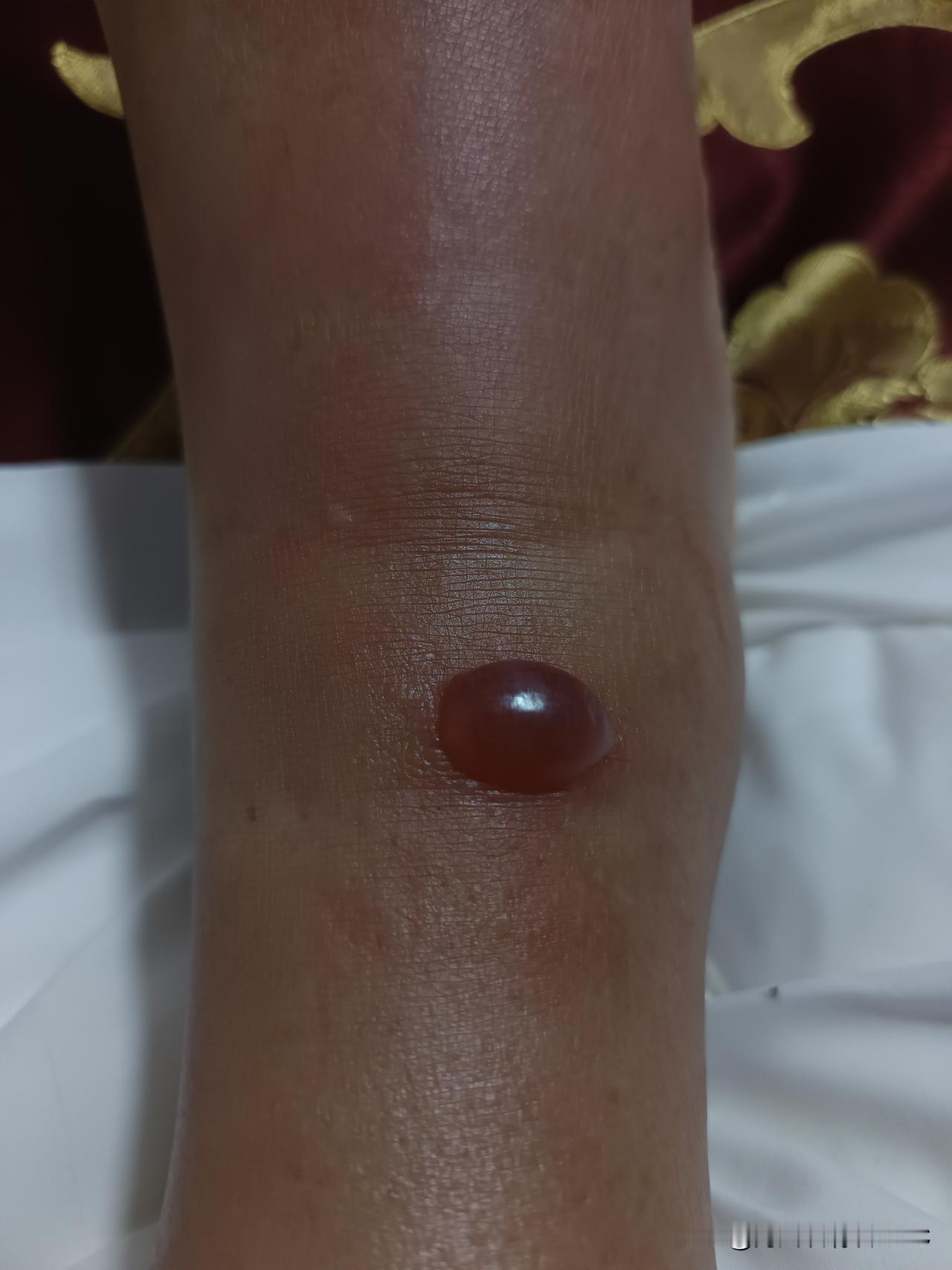 到武夷山了，坐了一天车，脚上的水泡越来越大了，整个右脚都肿了起来，这会静静的躺在