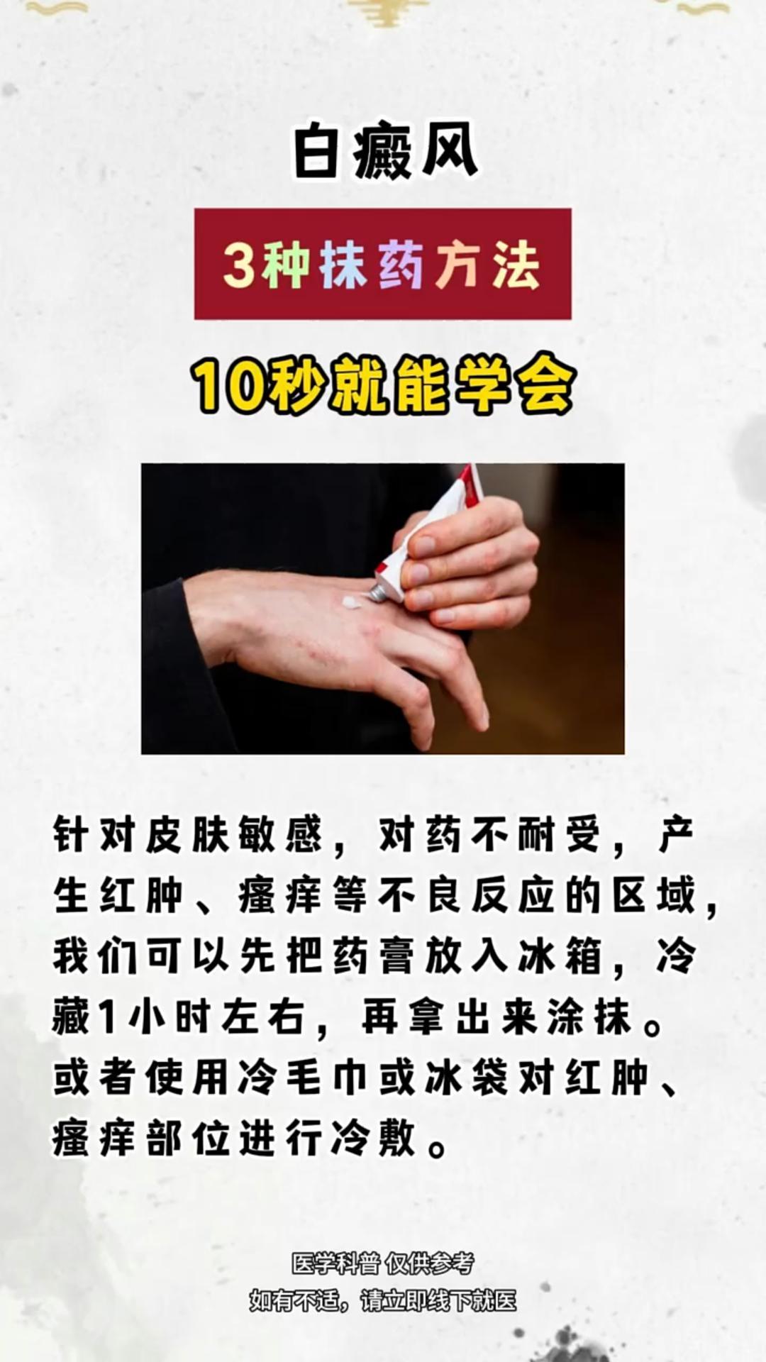白癜风 白斑 白癜风患者