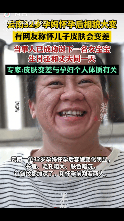 解释不清了！云南，一名32岁女子怀孕后容貌大变，和孕前判若两人，有网友猜测是怀的