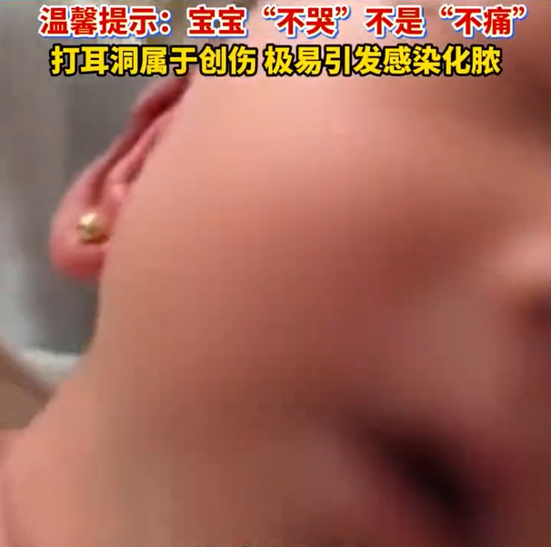 女子徒手给月子里宝宝打耳洞新生儿身体发育尚未成熟，本不该过早打耳洞，这种传统陋习
