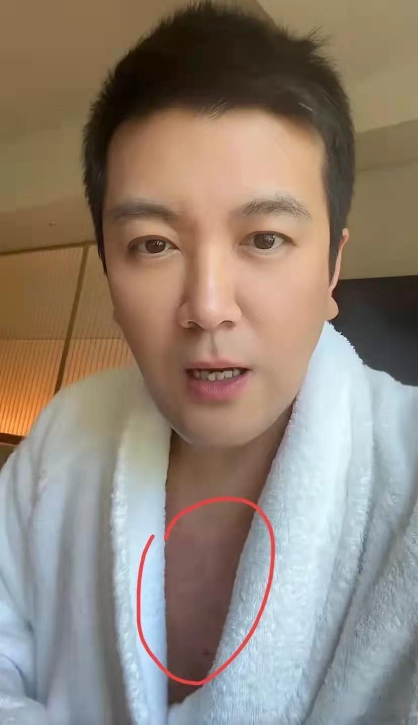 杨子带儿子日本旅游，穿睡袍露出满胸疤痕，吃饭听儿子的变身慈父，小儿子好帅啊！ ​