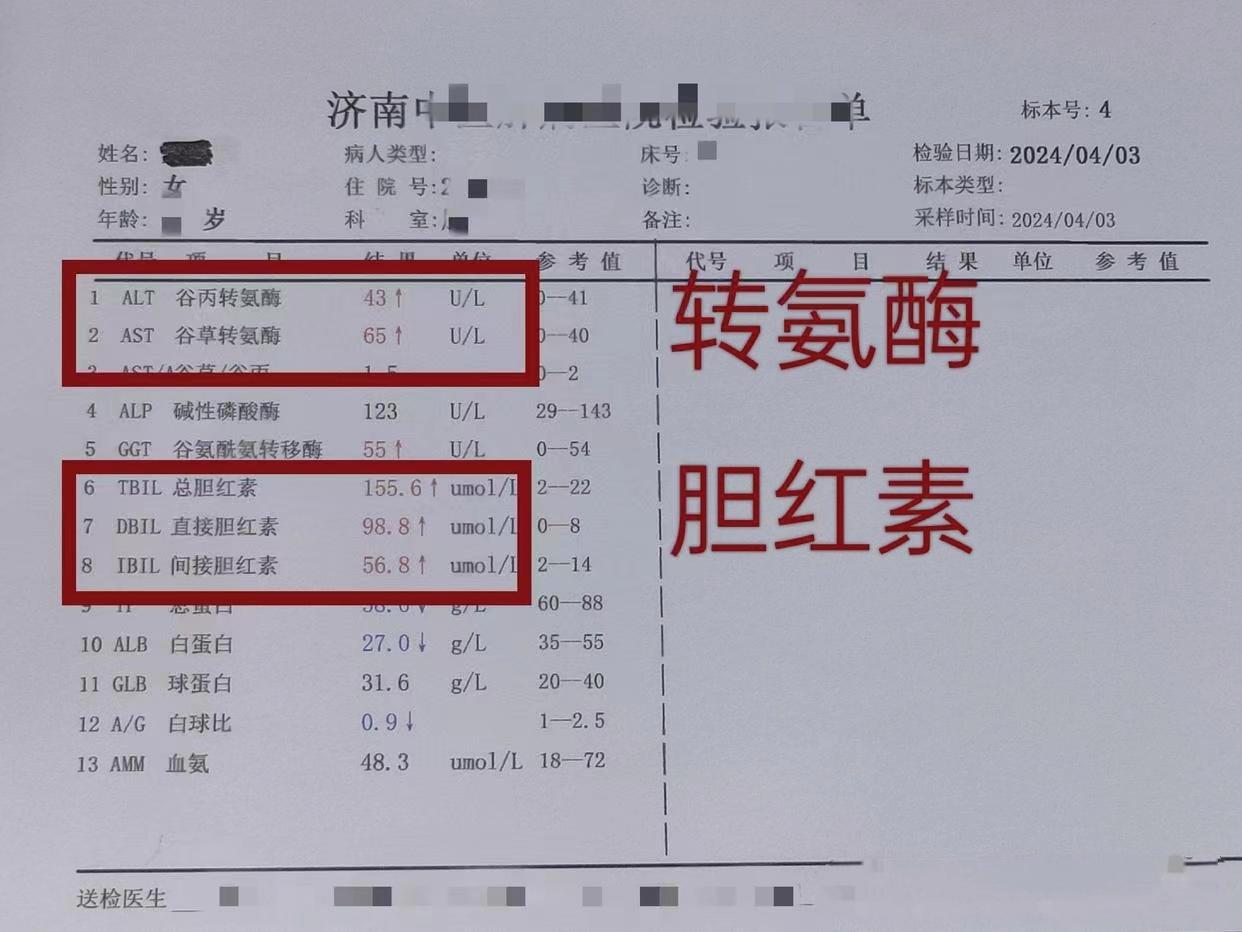 肝功能指标升升降降，最害怕的是这两项一高一低！ 每位肝病朋友对于肝功能...