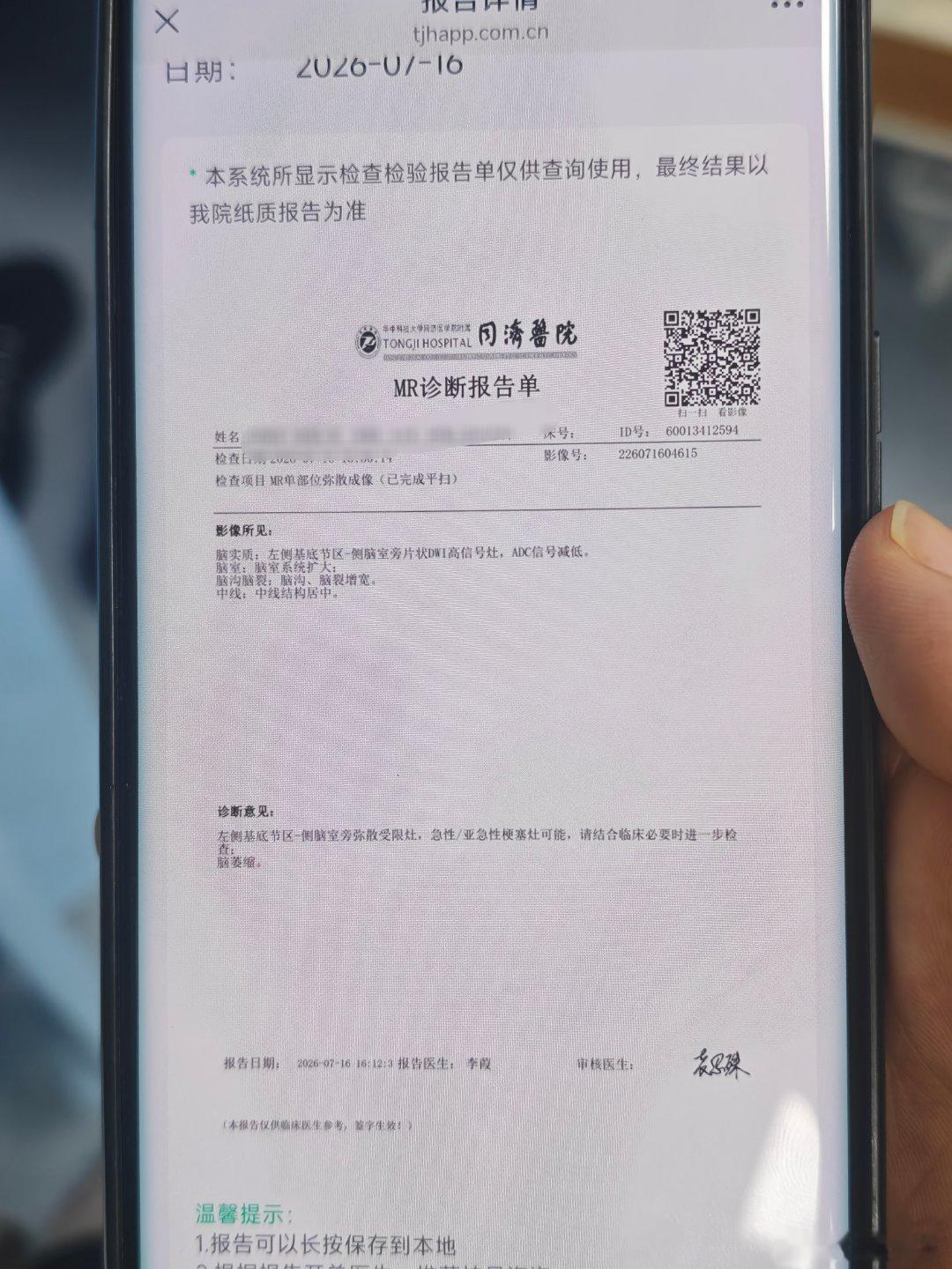 求助各位兄弟，感激不尽有没有网友懂中老年人脑梗的，主要是后面康复的问题，包括中医