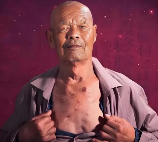 1956年，35岁的农民咳嗽10年，但却一直拒绝就医，一天，他突然用力一咳，一个