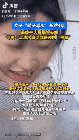 湖南长沙，一女子持续4年流清水鼻涕，并且经常发热，却被多次误诊，直到最近女子突发