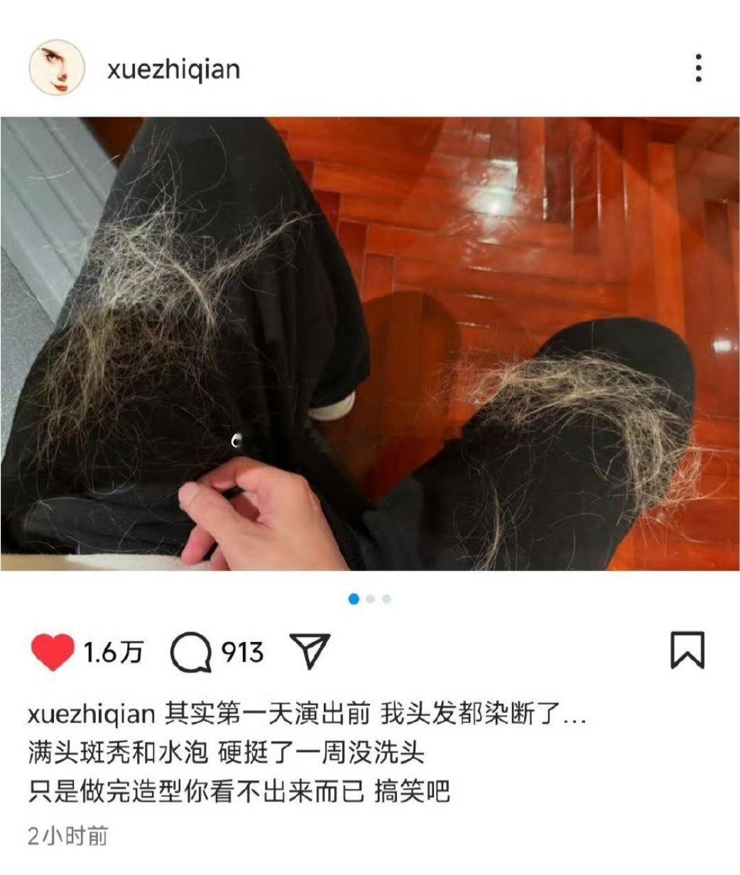 薛之谦满头斑秃和水泡一沫真挚的情话薛之谦满头斑秃和水泡！一沫真挚的情话