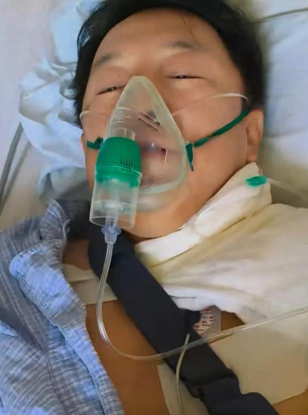 黄渤接连出事！9 月 3 日，手臂骨折还没康复的黄渤又出事了，这次伤势更为严重。