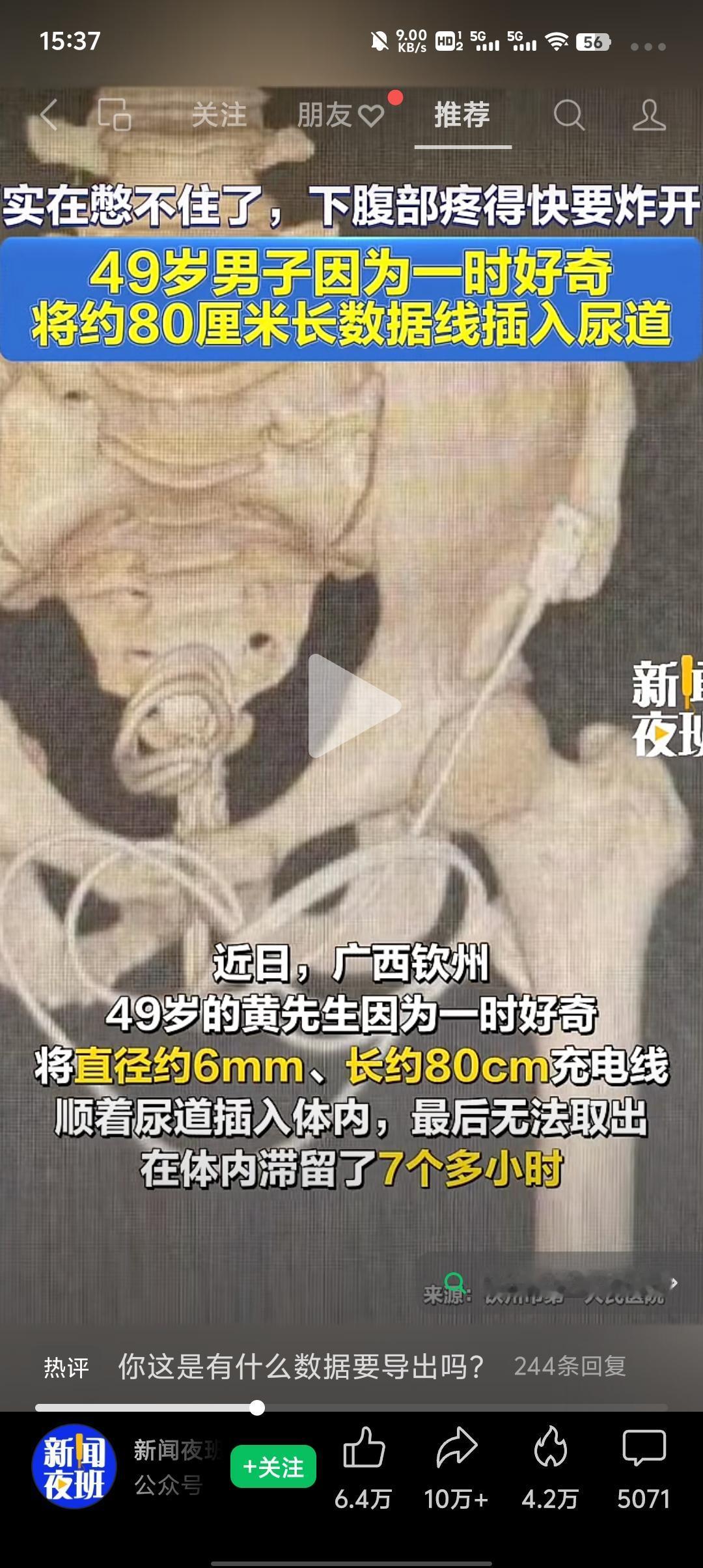 一时糊涂！广西49岁男子因好奇，把80cm充电线塞进尿道，被困体内7小时
 
猎