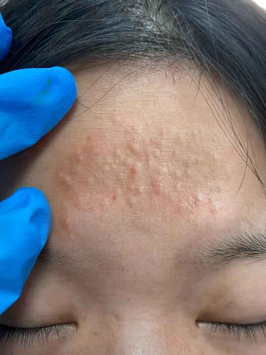 谁懂啊！！这样这样搞闭口真没了！！！