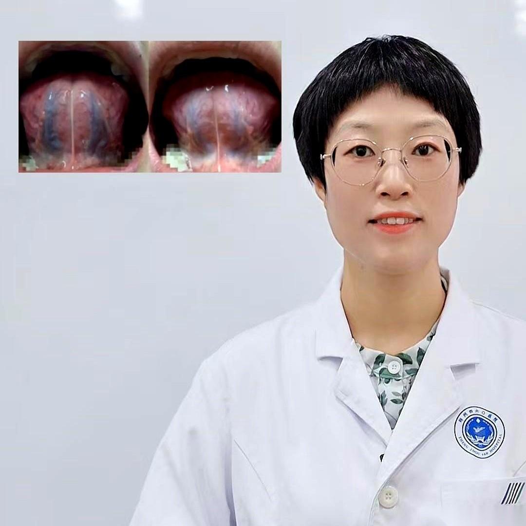 伸出舌头，自己照镜子看看底下。
是不是有两条又粗又黑的“青筋”？感觉整个人都钝钝