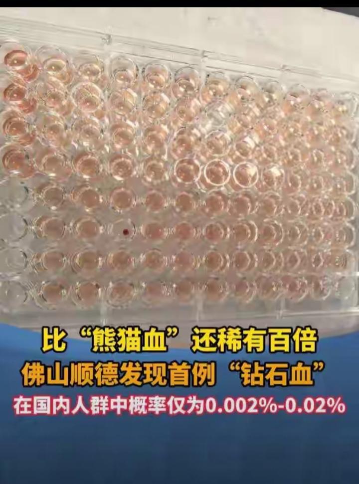 首例比熊猫血更稀有的血型，钻石血！在广东顺德被发现，比“熊猫血”罕见百倍！
记者