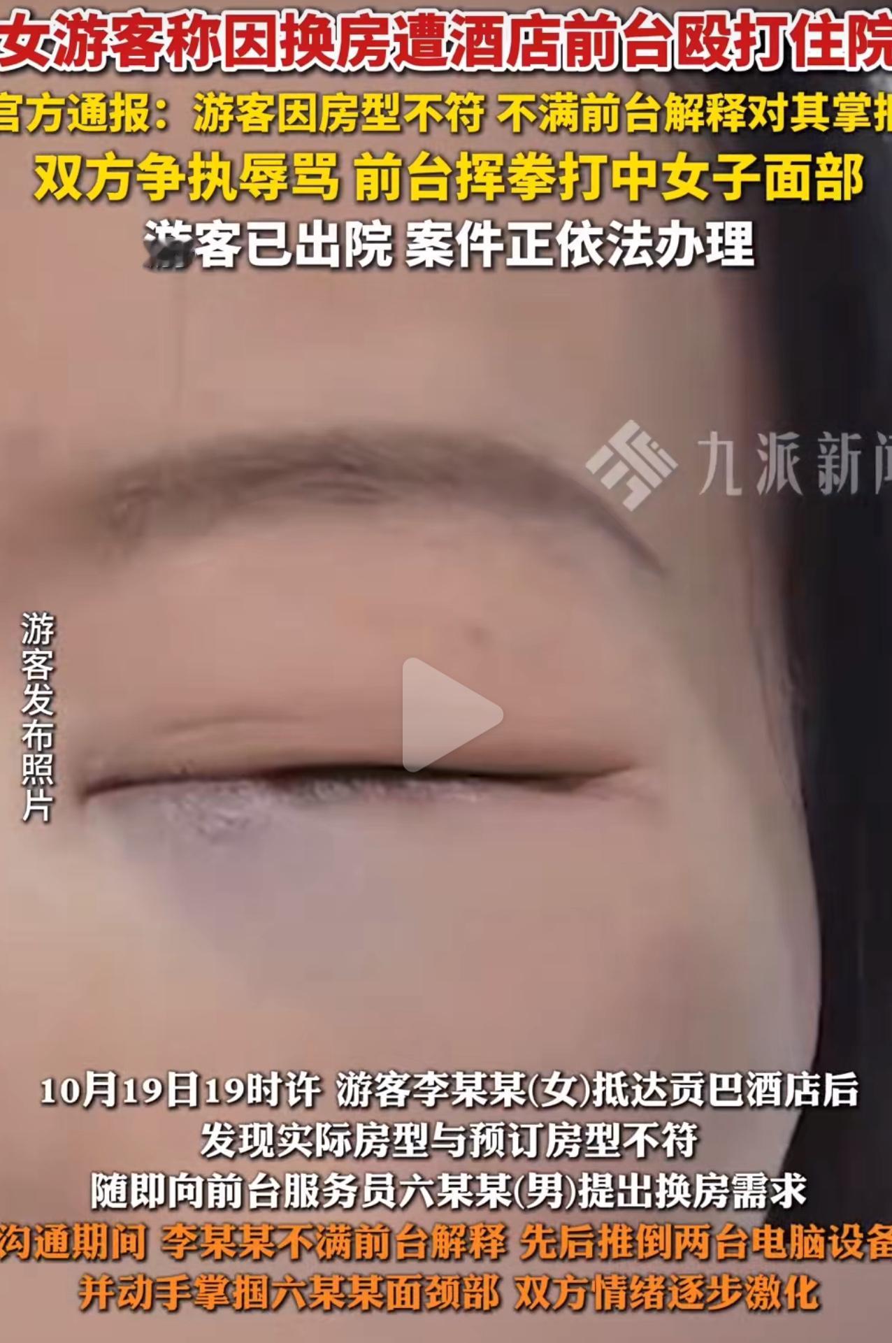 住酒店开错房，女的掌掴前台反被揍！谁出门住酒店没碰过不痛快的？可四川阿坝这女的，