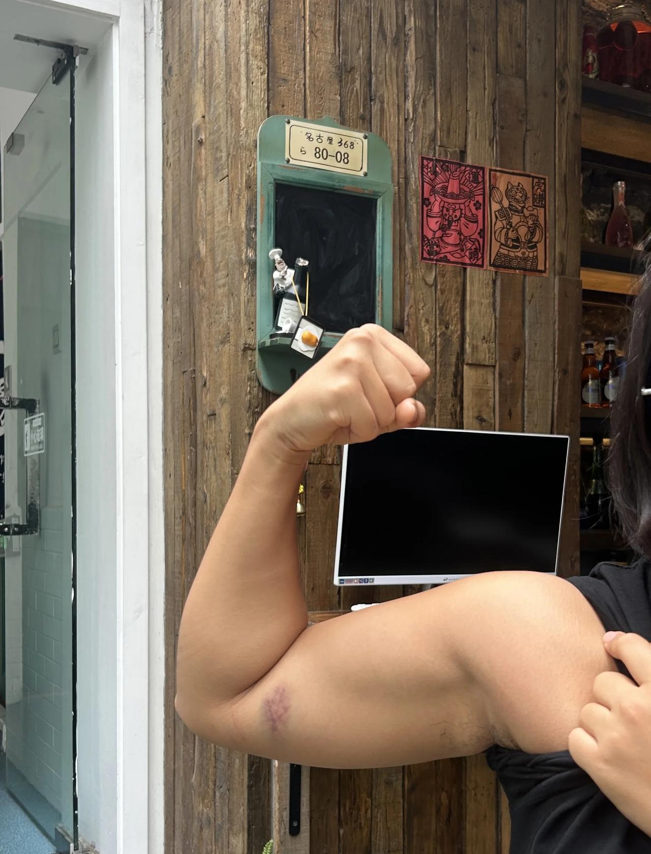 昨天跳水给自己砸了个大淤青
亮马河跳水好玩