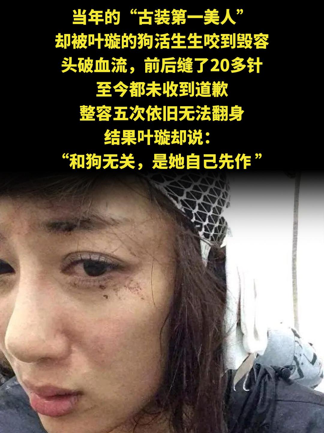 当年的“古装第一美人” 却被叶璇的狗活生生咬到毁容 头破血流，前后缝了...