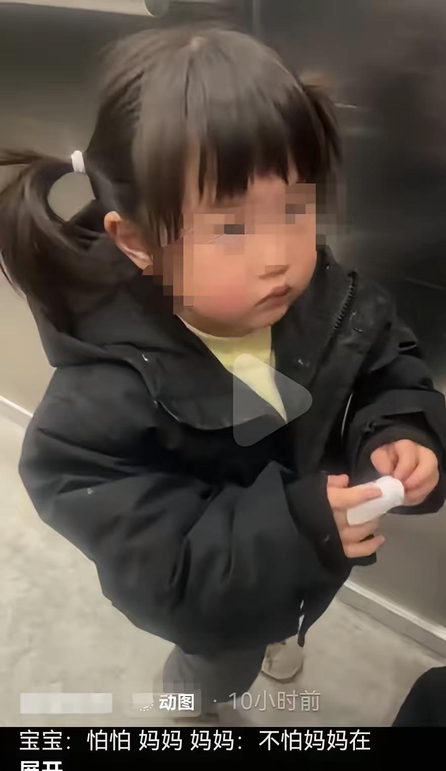 网友发的图片，六安被打的2岁女童
两岁的孩子，右手中指骨折，孩子身上还有伤，耳膜