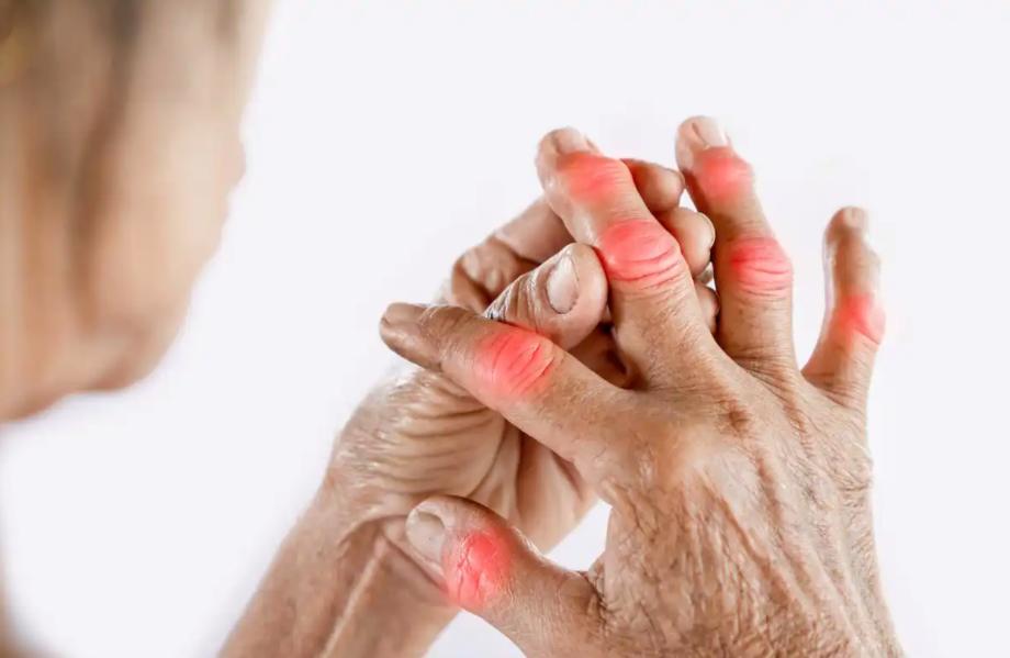 听说过有人手上鼓了个包，白白的、硬硬的，还以为是个普通的脓包，一狠心挤了一把，结