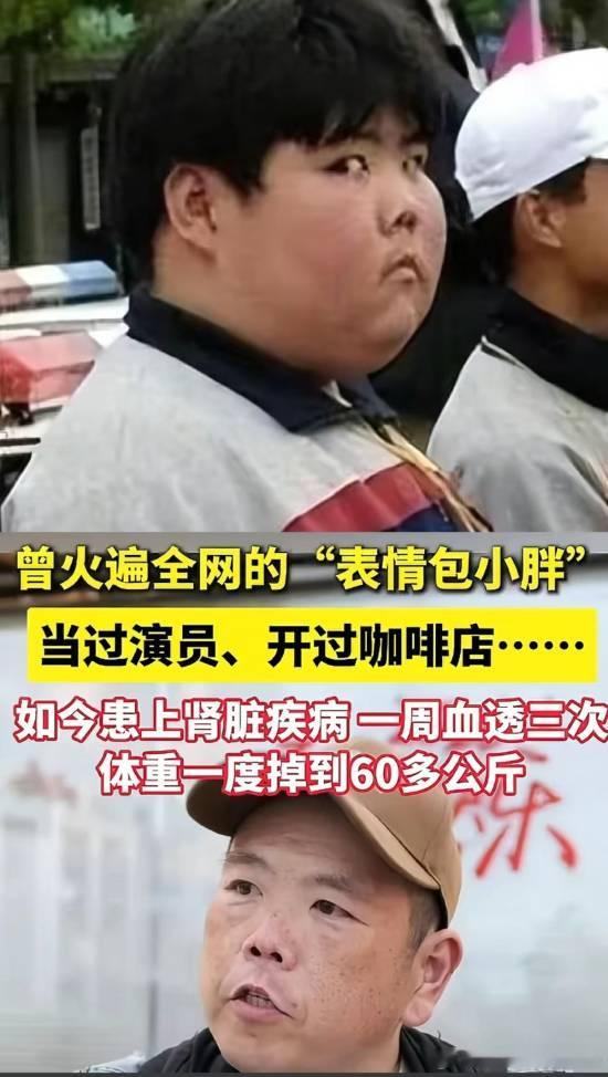 网红小胖一周透析3次：曾因表情包爆火据媒体报道，曾经火爆全网的“网红小胖”如今样