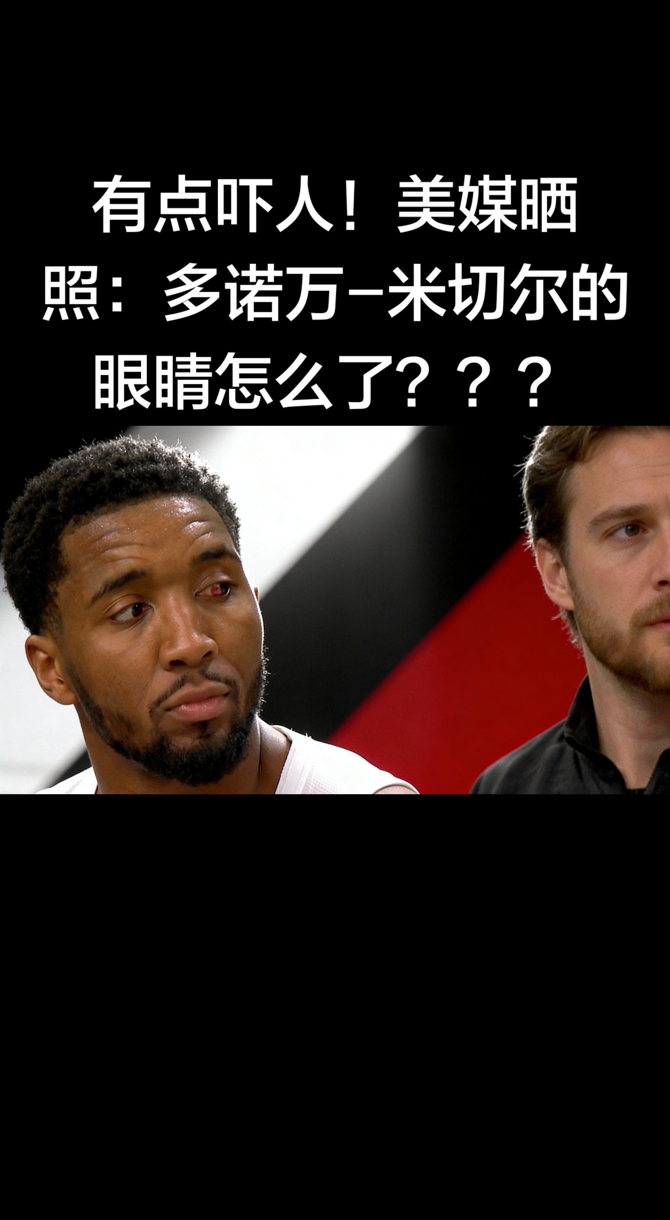 👁️ 米切尔眼睛怎么了（3月18日 骑士vs雄鹿）   - 原因：比...
