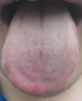 补足下焦元气，滋养海绵体根本






很多伤精多年的男士朋友们也在努力坚持戒