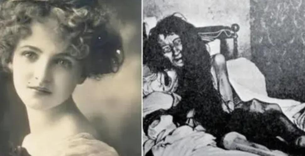 这个周围恶臭，衣不蔽体地躺在粪堆里，瘦成皮包骨的女子，曾被称为“法国最美女子”。