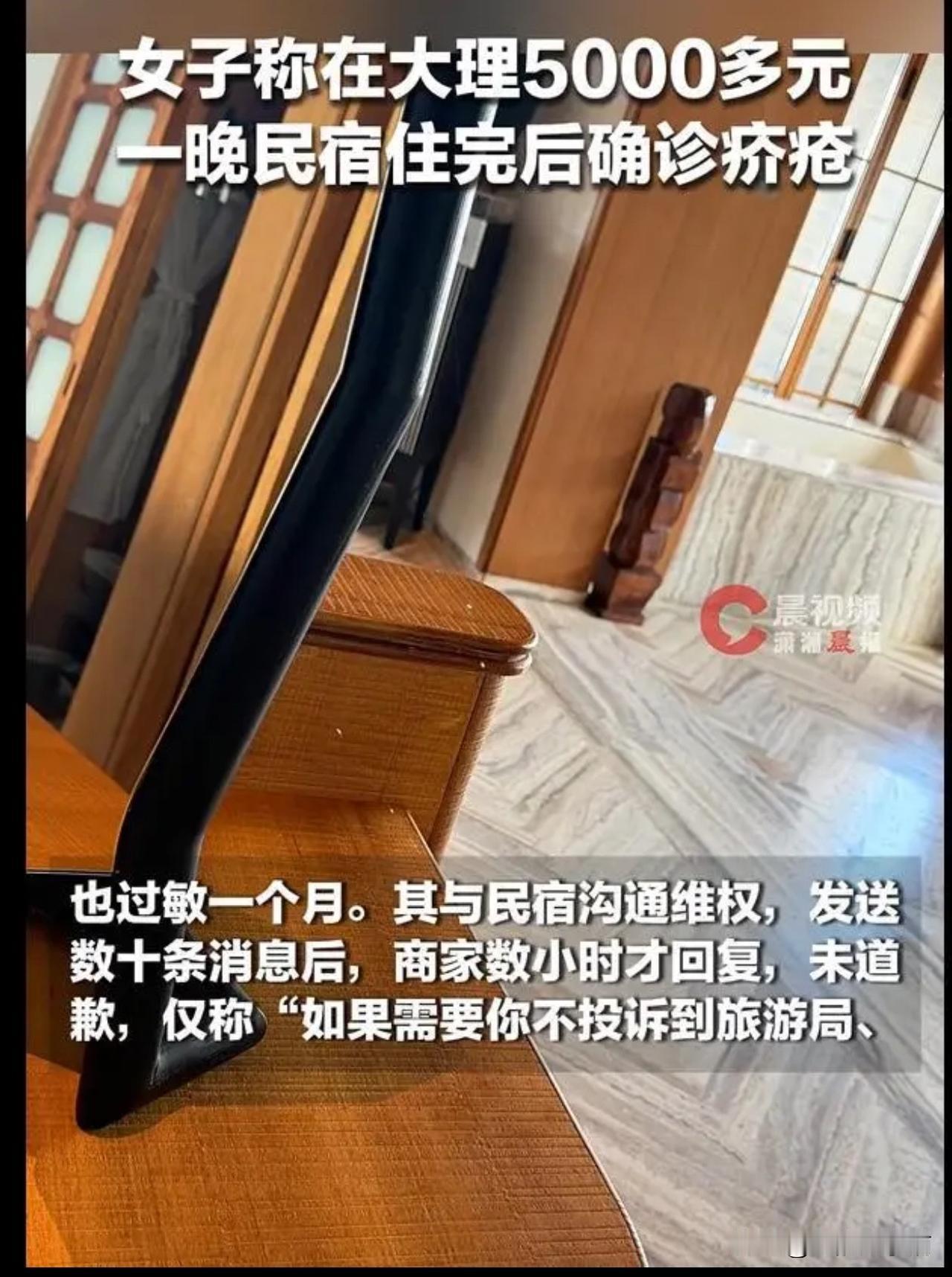 李女士花5000元在大理民宿住一晚，
竟传染上芥疮，
民宿问她：“你要我给你多少