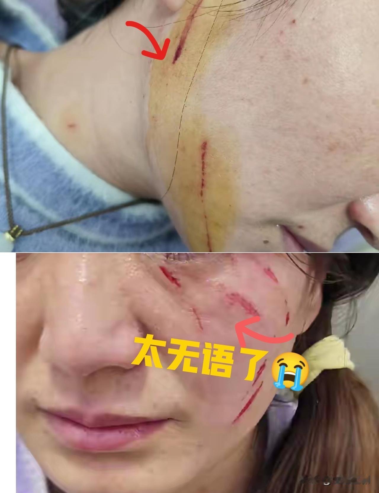 脸上的疤还疼，心更凉！真没人懂被强势婆婆逼到绝境的滋味吧？她说东你不能往西，一点