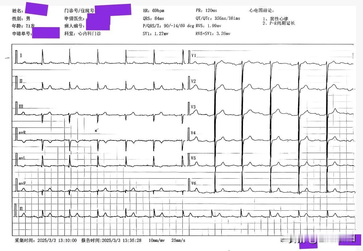下午在中医院出诊，心内科医师拿着一份心电图进来，后面跟着患者和心电图室医生，两位