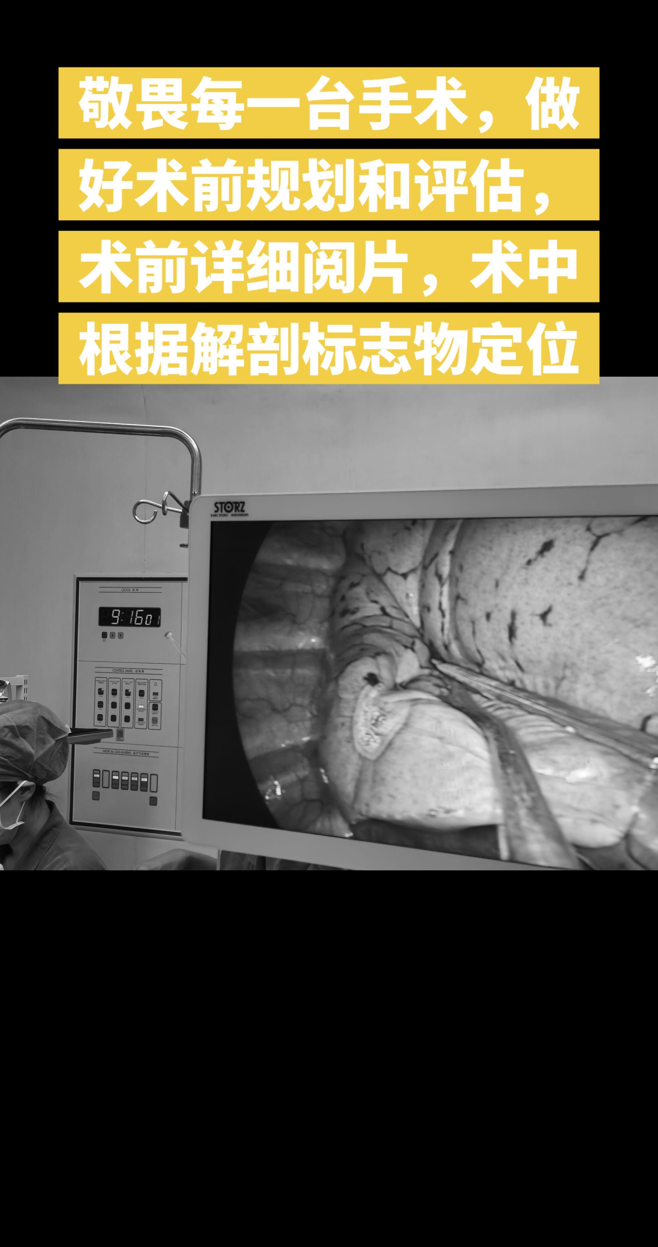 敬畏每一台手术，如何选择手术方式？楔形切除、肺段切除or肺叶切除是根据...