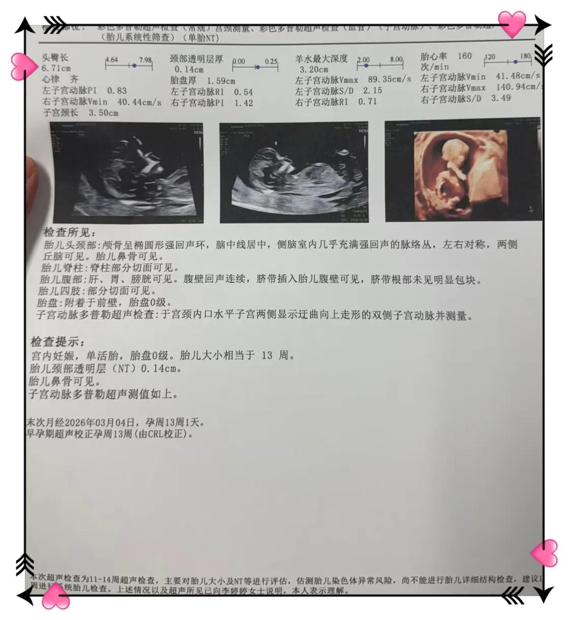 NT顺利通关✨
 
NT产检一次过，悬着的心终于放下！宝宝发育符合孕周，NT0.