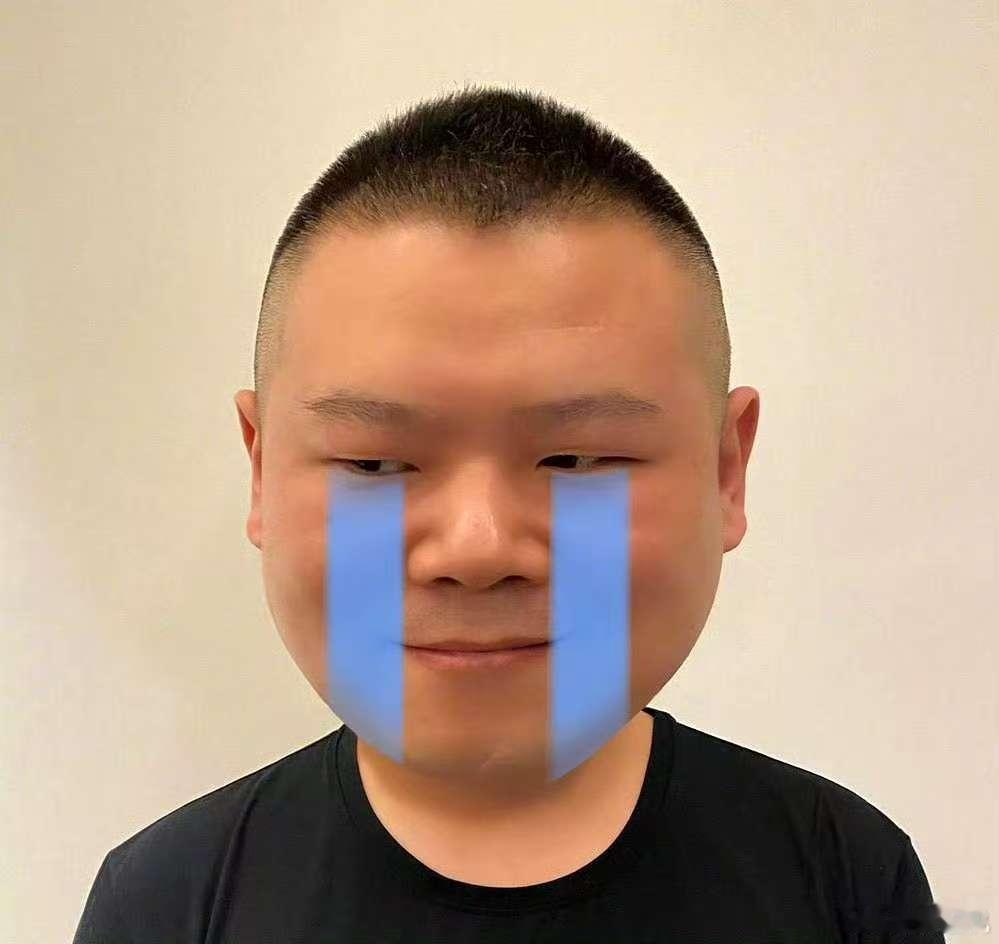 岳云鹏试药差点人没了 家人们，笑不活了！综艺里岳云鹏为证药粉无毒，被张鹤伦怂恿当