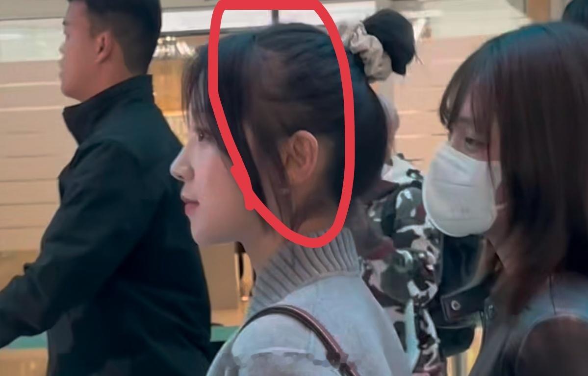 tg 粉丝怎么不买点 米诺地尔送给她？ ​​​
