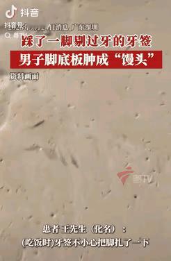 悲剧还是发生了！广东深圳，一男子饭后用牙签剔牙，之后顺手把牙签一扔，一个没注意就
